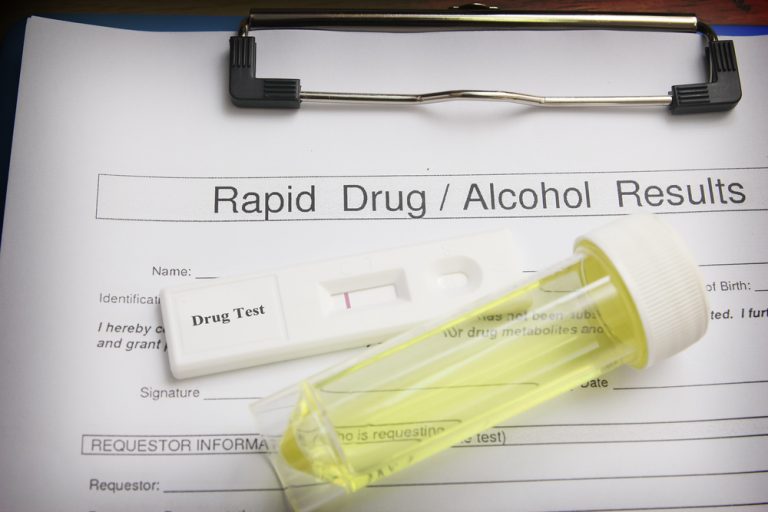 Drug Testing & Lab Testing Assured Detective Agency